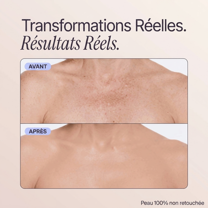 Perfect Skin Coverage