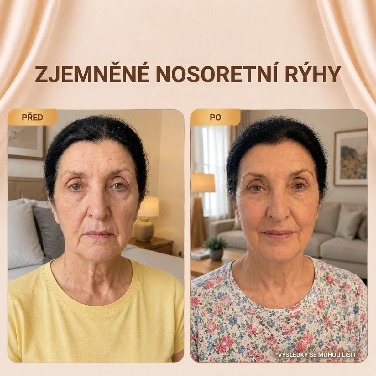 Velloriya Serum (CS)
