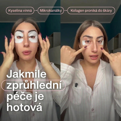 Peptidové polštářky pod oči