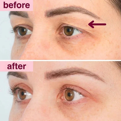 Peptide Eye Patches
