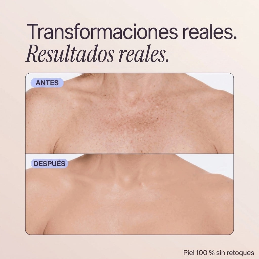 Velloriya Perfecteur (ES)