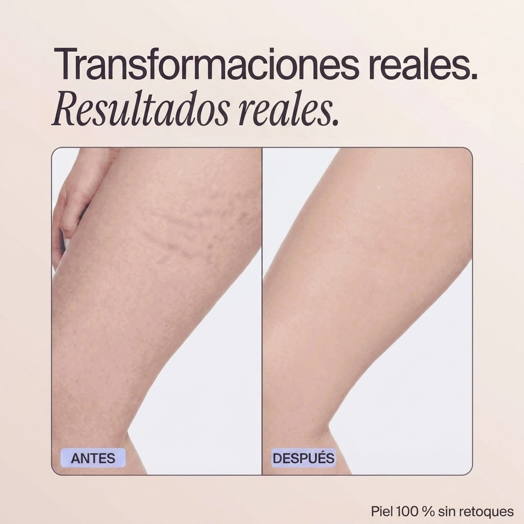 Velloriya Perfecteur (ES)
