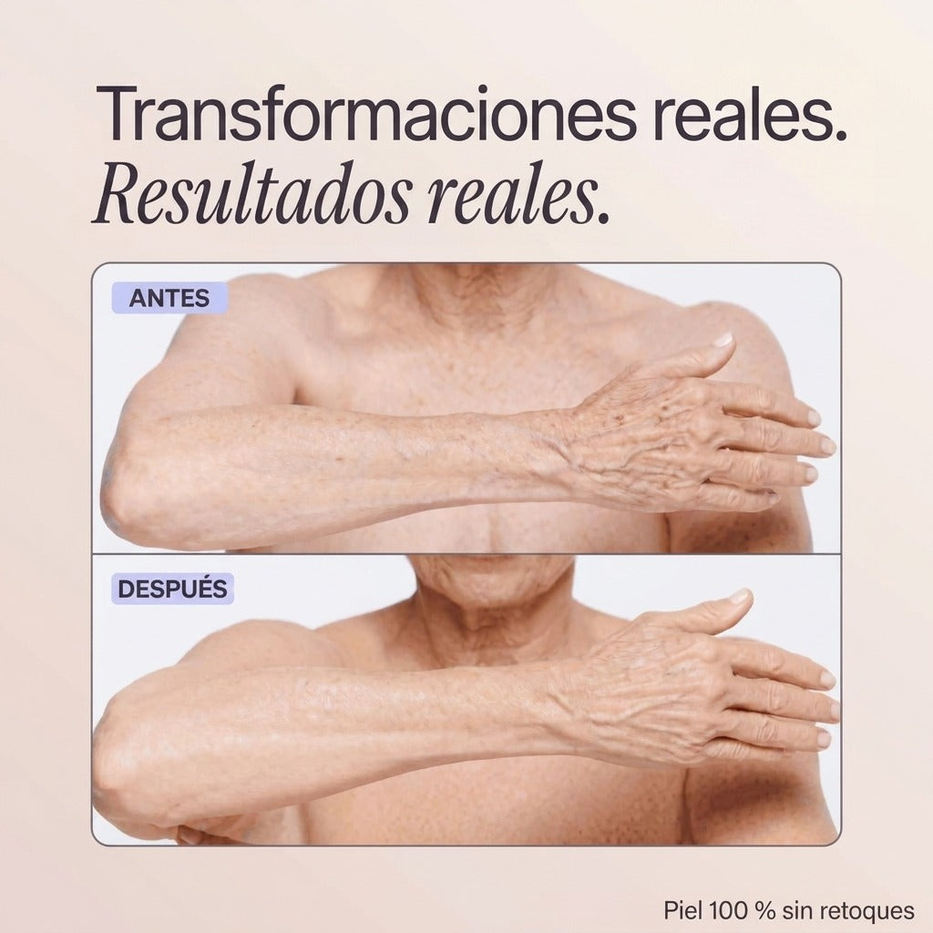 Velloriya Perfecteur (ES)